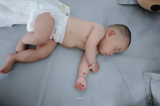 辽阳六个月宝宝眼睛散光